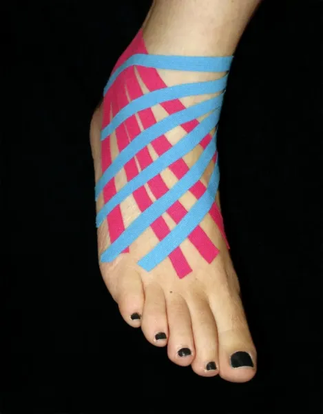 Taped Sprained Ankle Print (C017 Art Prints, Posters
