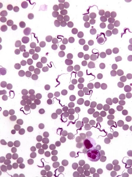 Trypanosomes in blood smear, SEM C016  /  5783