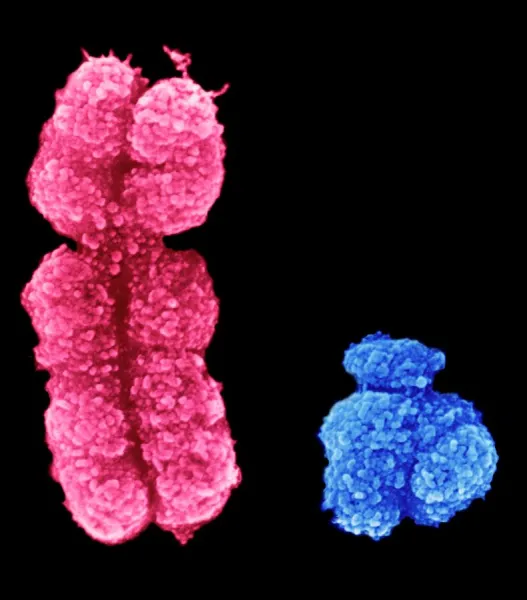 X and Y chromosomes; coloured scanning electron micrograph