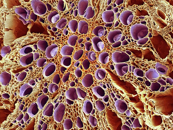 Xylem tissue, SEM. Xylem tissue. Coloured scanning electron micrograph 