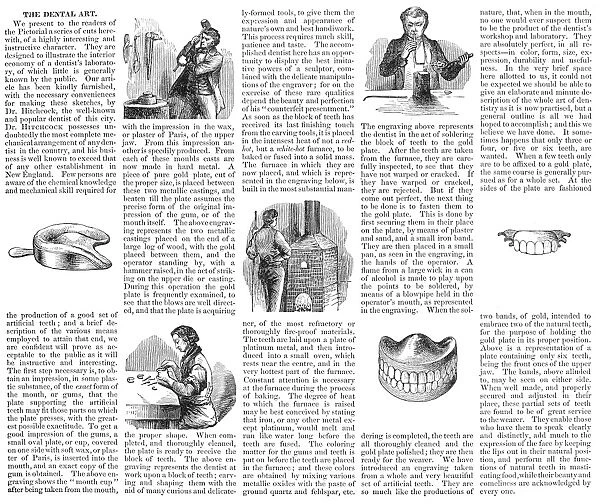 The making of dentures. From an American newspaper of 1853