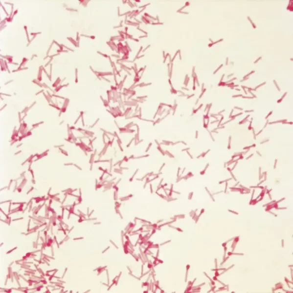 Clostridium tetani, causative agent of tetanus Our beautiful Wall Art