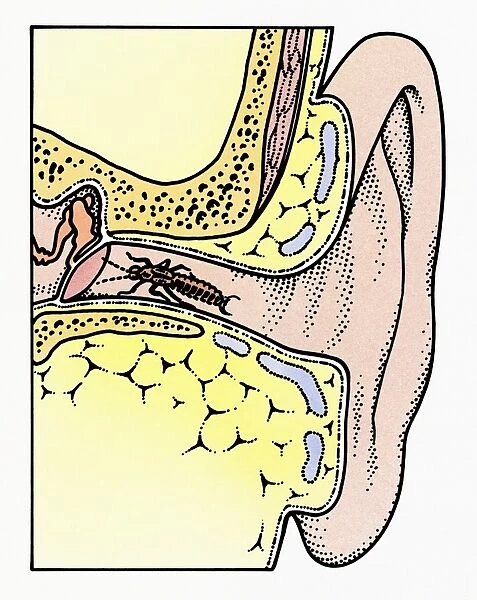 Cross section illustration of Common Earwig (Forficula auricularia) in auditory canal of ear, touching tympanic membrane with antennae