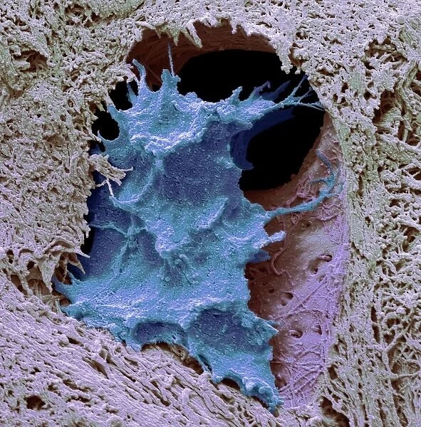 Osteocyte bone cell, SEM