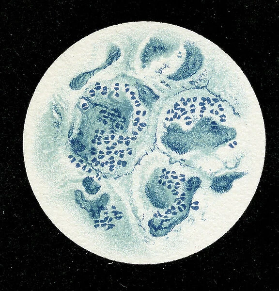 Colony of Micrococcus Gonorrhoea found in the Urethra, 1906 (litho)