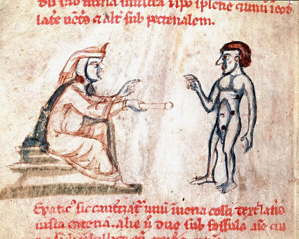 The doctor burns the patient on painful areas with hot irons, 13th century (minniature)