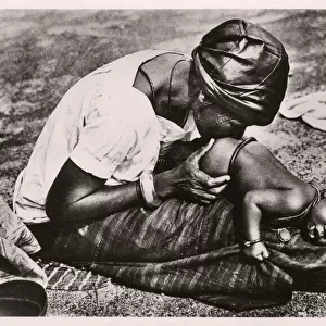 Niger, West Africa - Baby receiving an enema