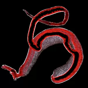 Schistosoma spp. blood flukes