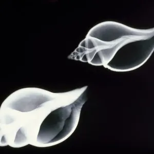 Coquillages - radiographie. Coquillages - radiographie.
