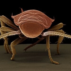 Scanning Electron Micrograph (SEM): American Cockroach; Magnification x 40 (A4 size: 29. 7 cm width)