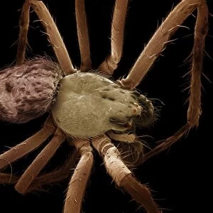 Scanning Electron Micrograph (SEM) : Garden Spider-male, Magnification x20 (A4 size: 29. 7 cm width)