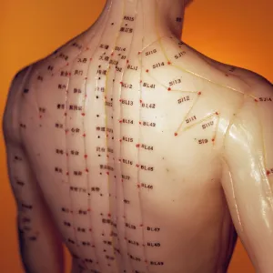 Acupuncture model