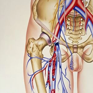 Artwork of deep vein thrombosis and bones in leg