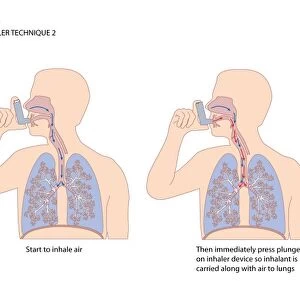Asthma inhaler use, artwork