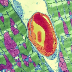 Cardiac muscle and capillary, TEM