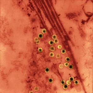 Colorado tick fever virus infection, TEM C016 / 9384