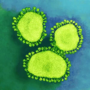 Coronavirus particles, TEM