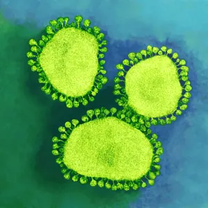 Coronavirus particles, TEM