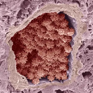 Crenated red blood cells, SEM C016 / 9029