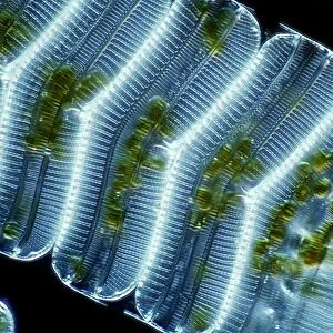 Diatoms, light micrograph C014 / 4674
