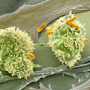 Dividing cancer cell, SEM C014 / 0361