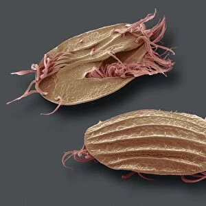 Euplotes protozoa, SEM C016 / 9040