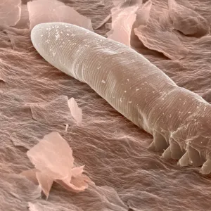 Eyelash mite, SEM