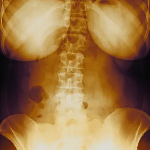 Female torso, X-ray