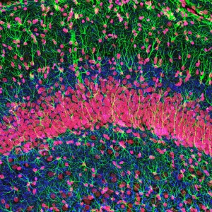 Hippocampus brain tissue