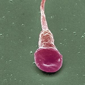 Human sperm cell, SEM