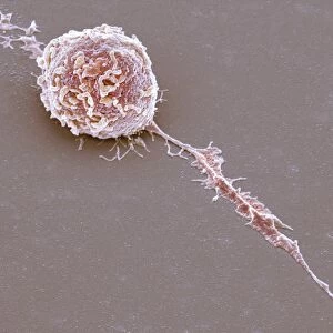 Microglial white blood cell, SEM C016 / 9119