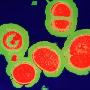 MRSA resistant Staphylococcus bacteria