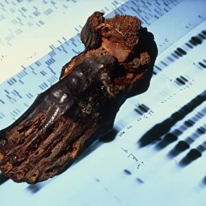 Mummified foot resting on DNA autoradiograms