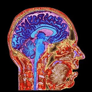 Normal human brain, MRI scan C016 / 8845