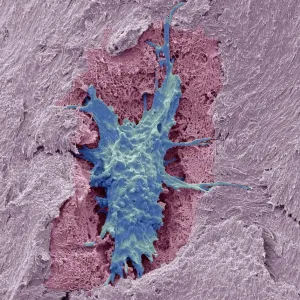 Osteocyte bone cell, SEM C016 / 9025