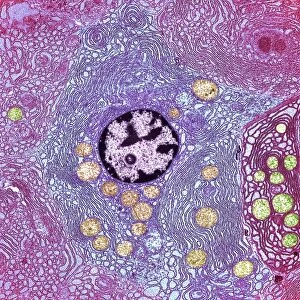 Pancreas cell, TEM