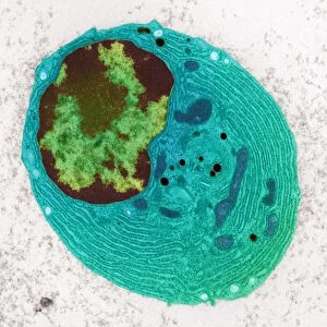 Plasma cell, TEM