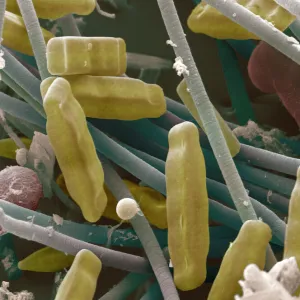 SEM of diatoms and blue-green algae