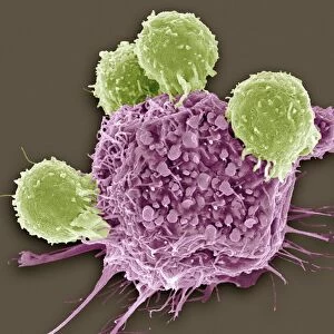 T lymphocytes and cancer cell, SEM C001 / 1679
