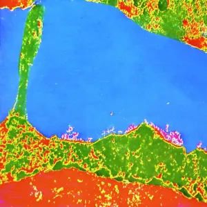 TEM of human white blood cell bearing HLA antigen