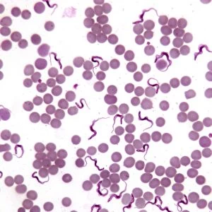 Trypanosomes in blood smear, SEM C016 / 5783