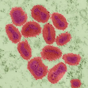 Vaccinia virus particles, TEM