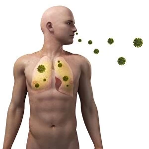 Viral lung infection, conceptual artwork