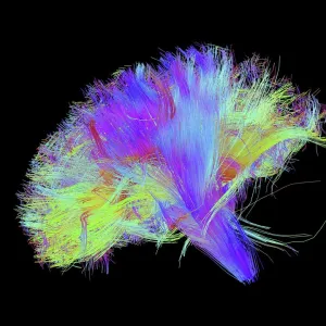 White matter fibres of the human brain C014 / 5666