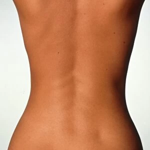 Womans back: posterior view of the torso