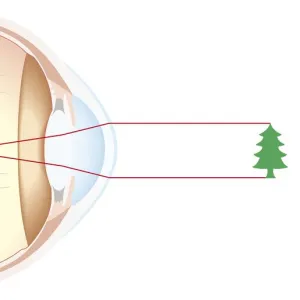 Cross section of human eye