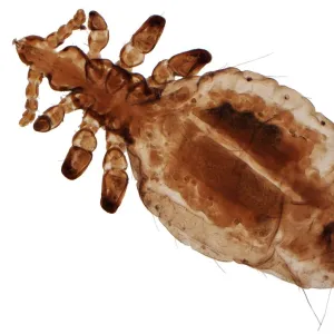 Human head louse, LM