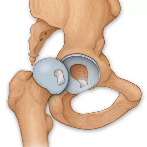 Normal anatomy of an open hip showing the articular surface of the femur