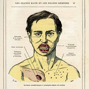 Figure of the book "Les grands maux et les grands remedes"