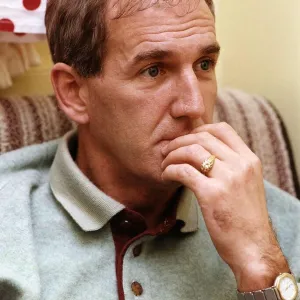 Russ Abbot in a theatre dressing room shows his Hair Transplant A©Mirrorpix